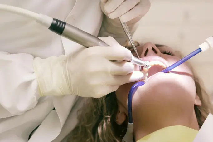Root canals