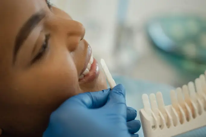Teeth whitening