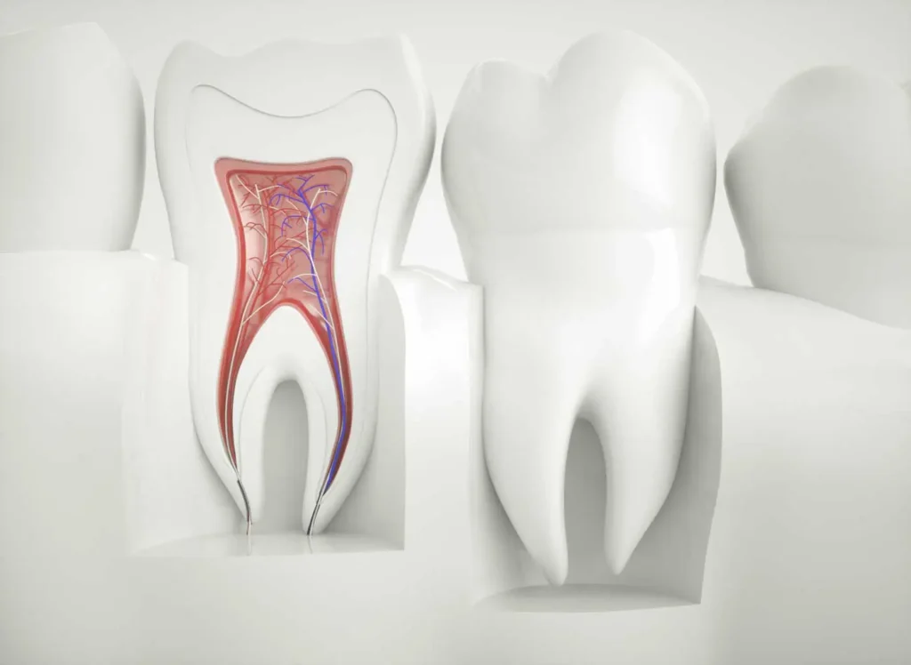 Tooth cross-section showing root canal treatment at Beamsville Smiles Family Dentistry